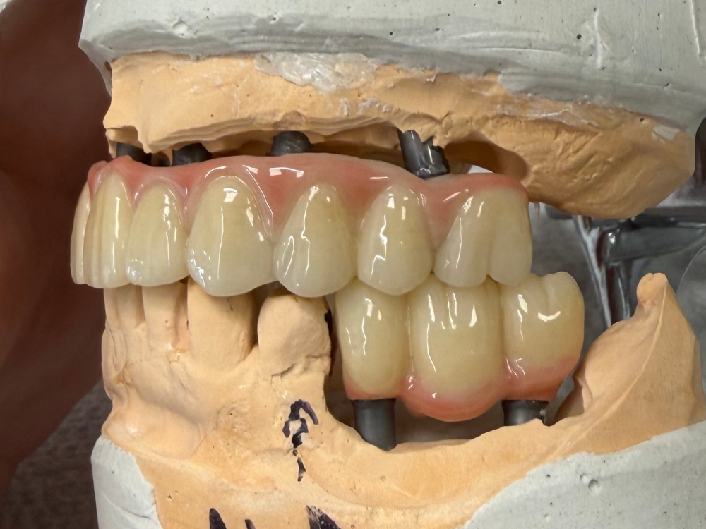 ArtyCad Dental Lab gallery photo 54