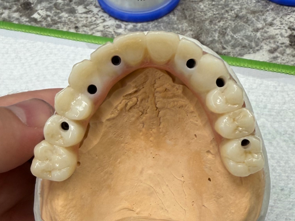 ArtyCad Dental Lab gallery photo 55