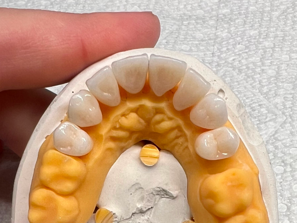 ArtyCad Dental Lab gallery photo 56