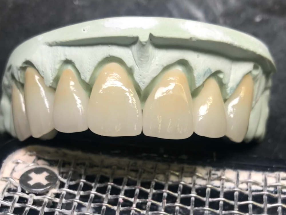 ArtyCad Dental Lab gallery photo 57