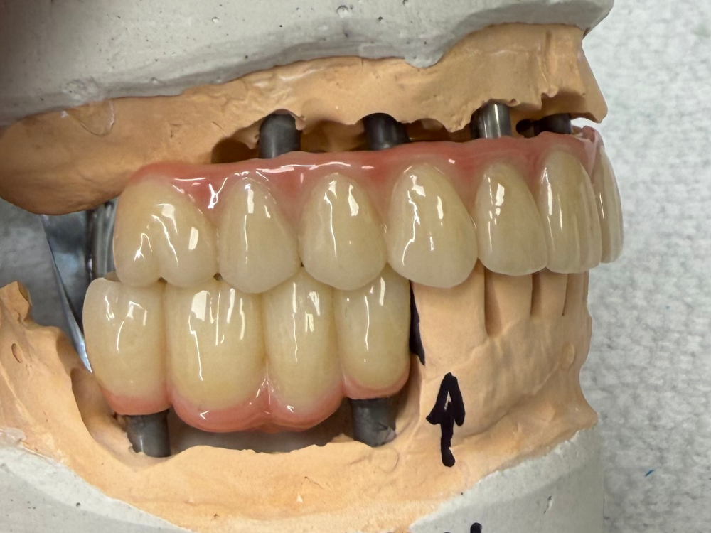 ArtyCad Dental Lab gallery photo 58