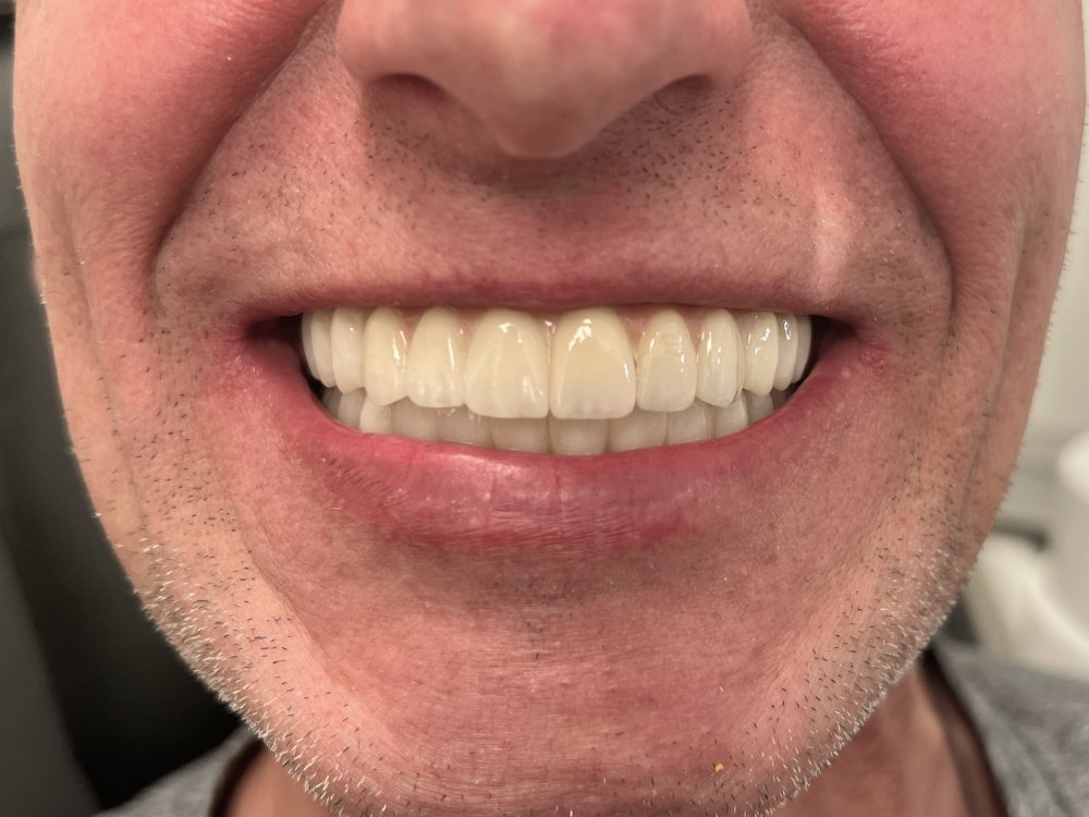 ArtyCad Dental Lab gallery photo 59