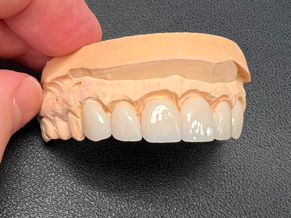 ArtyCad Dental Lab gallery photo 60
