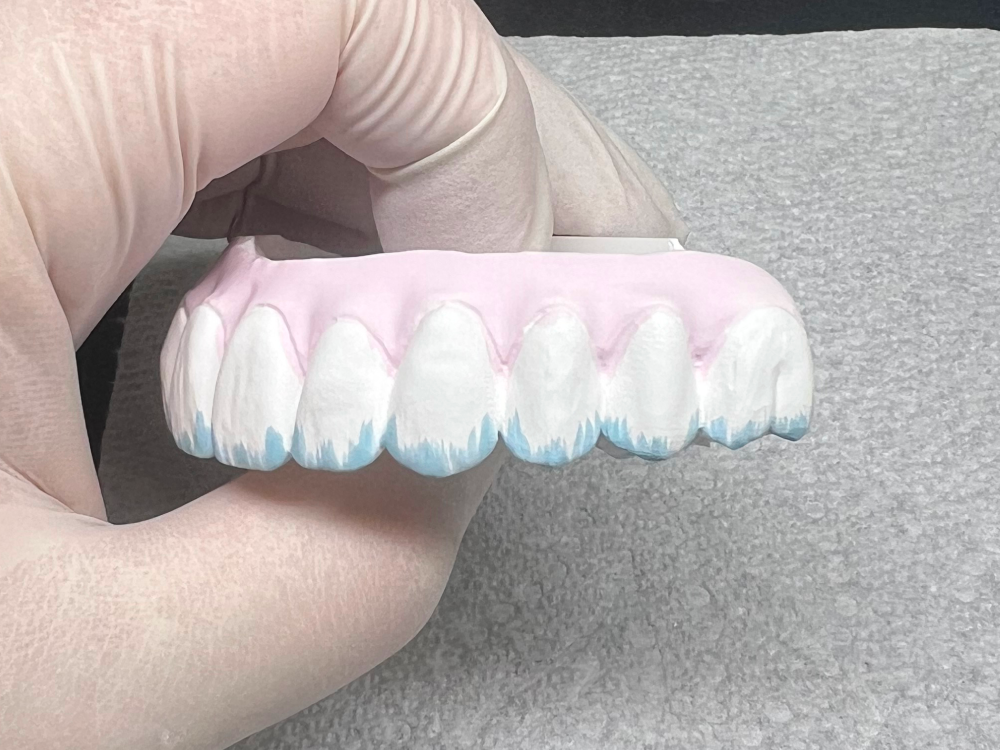 ArtyCad Dental Lab gallery photo 61
