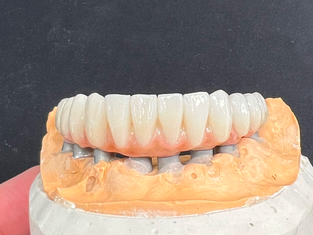 ArtyCad Dental Lab gallery photo 62
