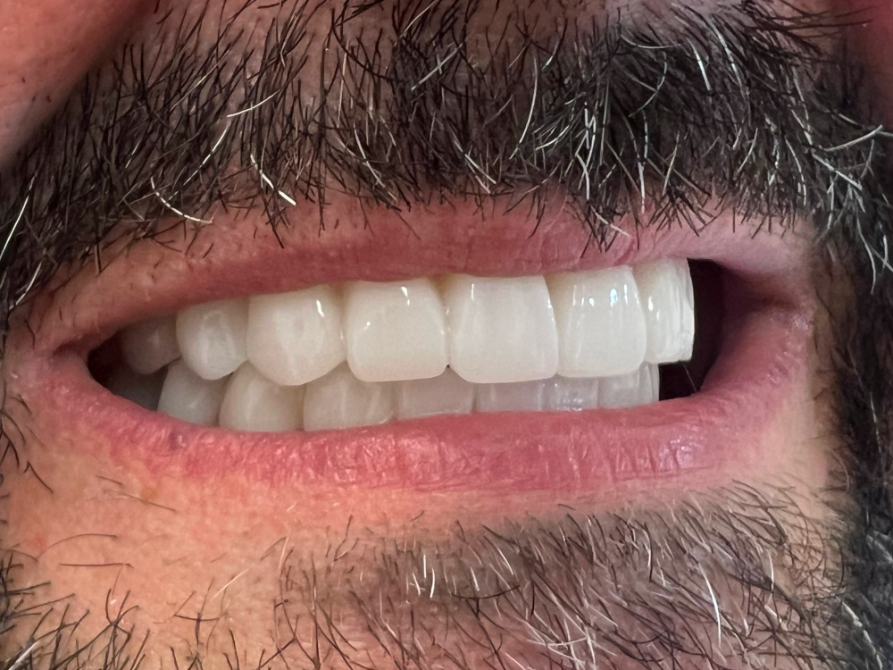 ArtyCad Dental Lab gallery photo 63