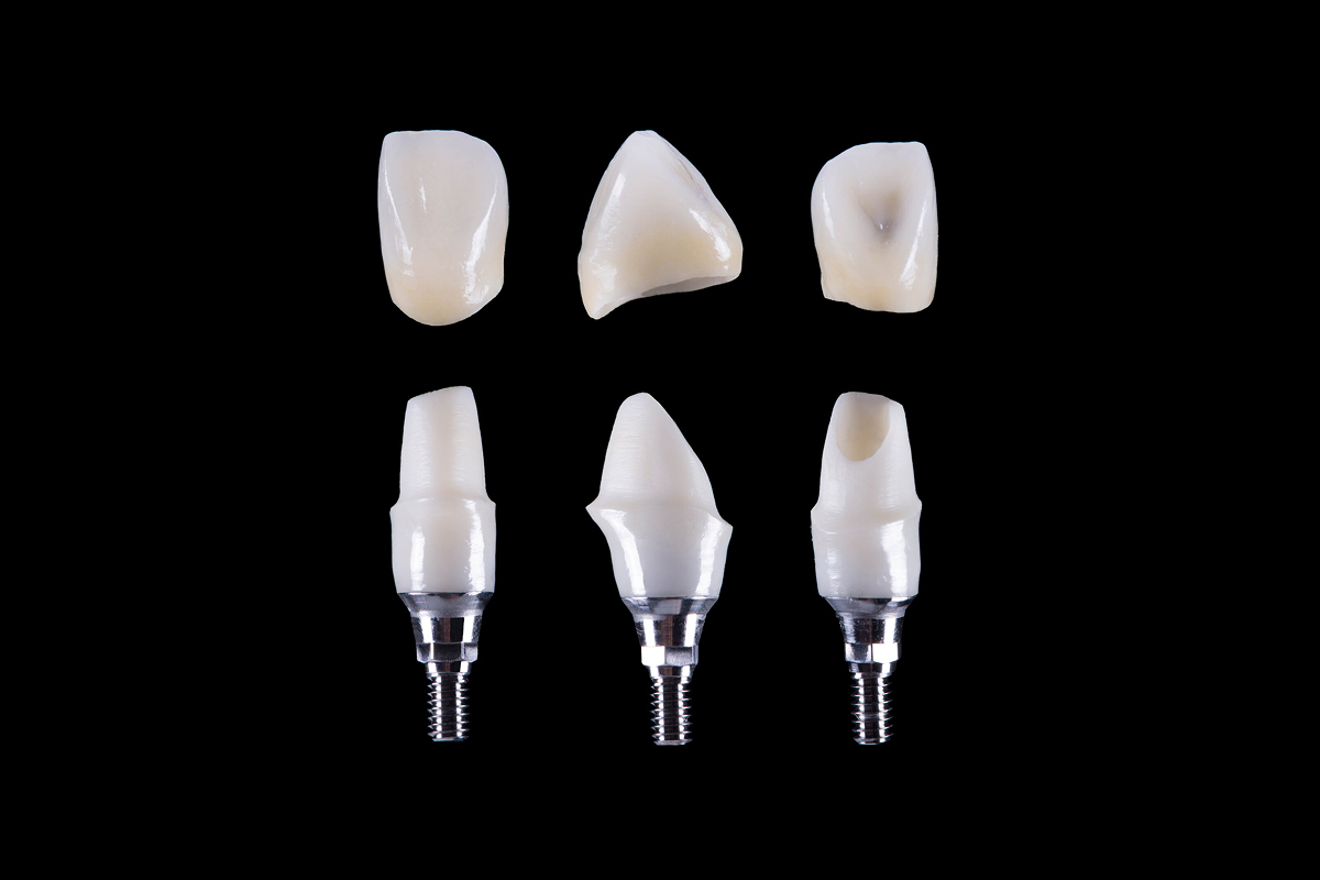 Multi-unit custom abutments for implant restorations