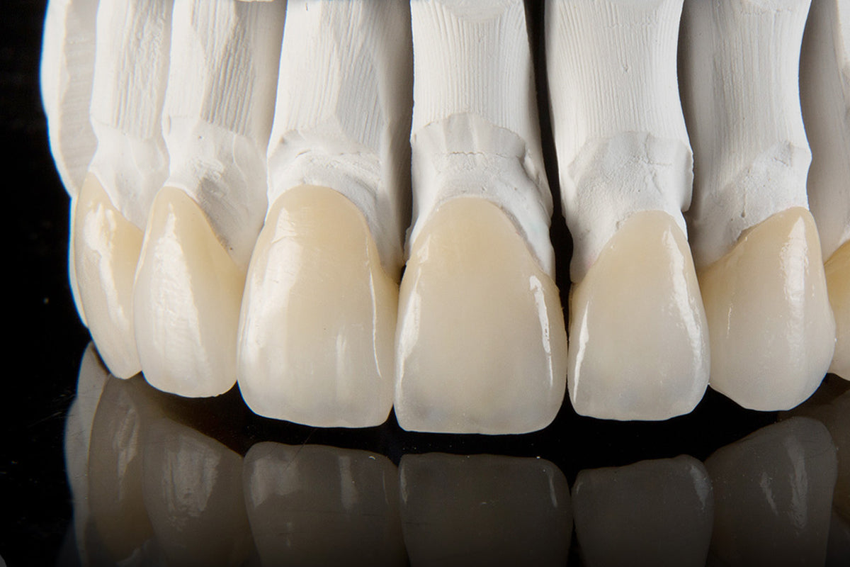Esthetic zirconia bridge restoration for ArtyCad Dental Lab