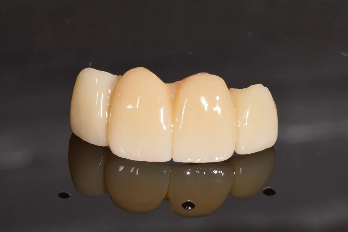 Temporary crown on model for ArtyCad PMMA temporaries