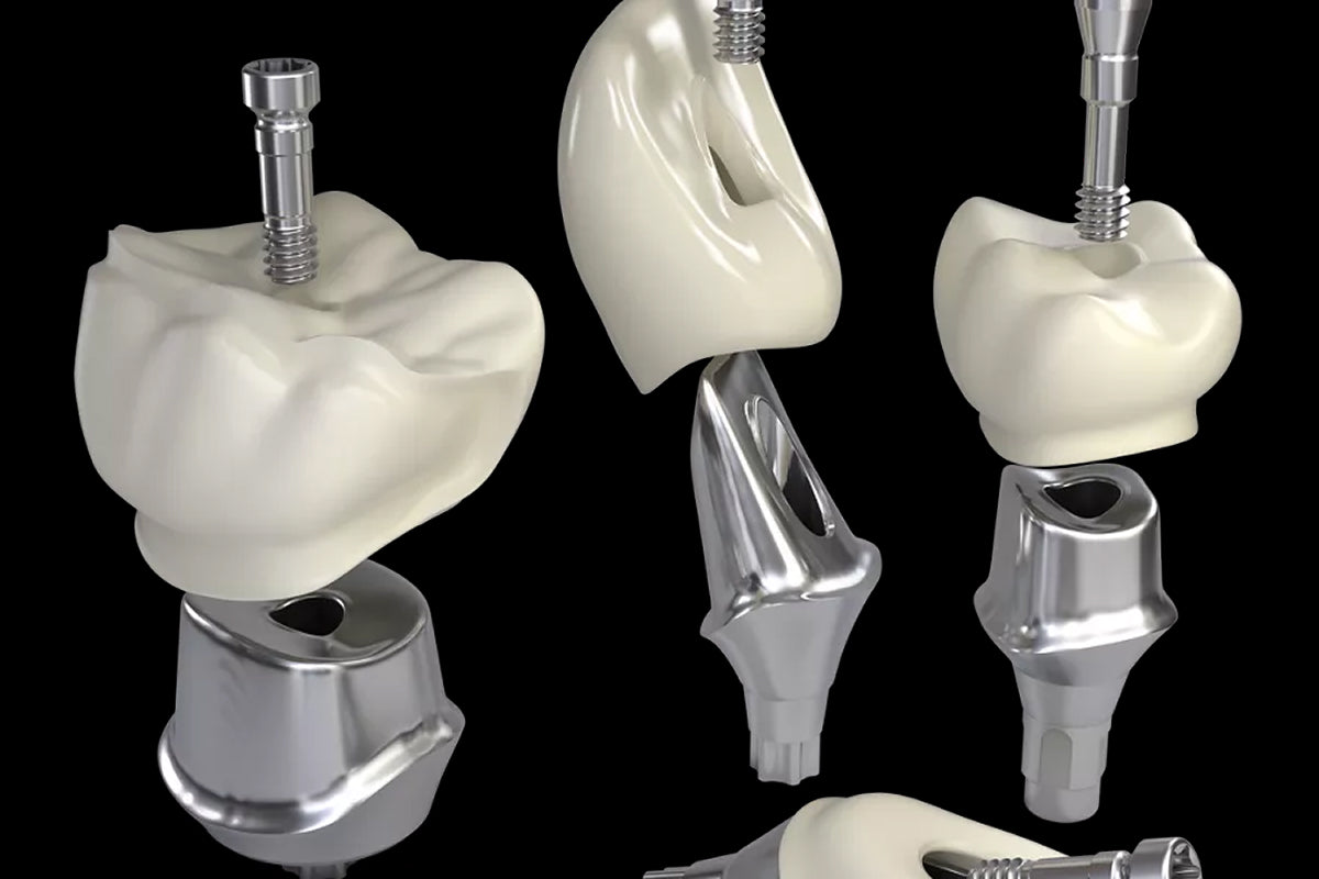 Screw-retained implant crown
