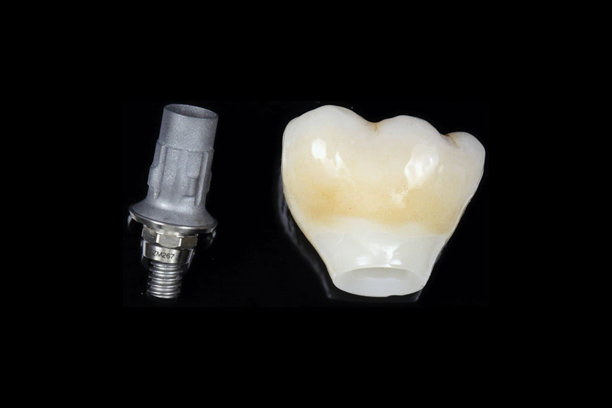 Implant crown restoration for Ti-Base crown cases