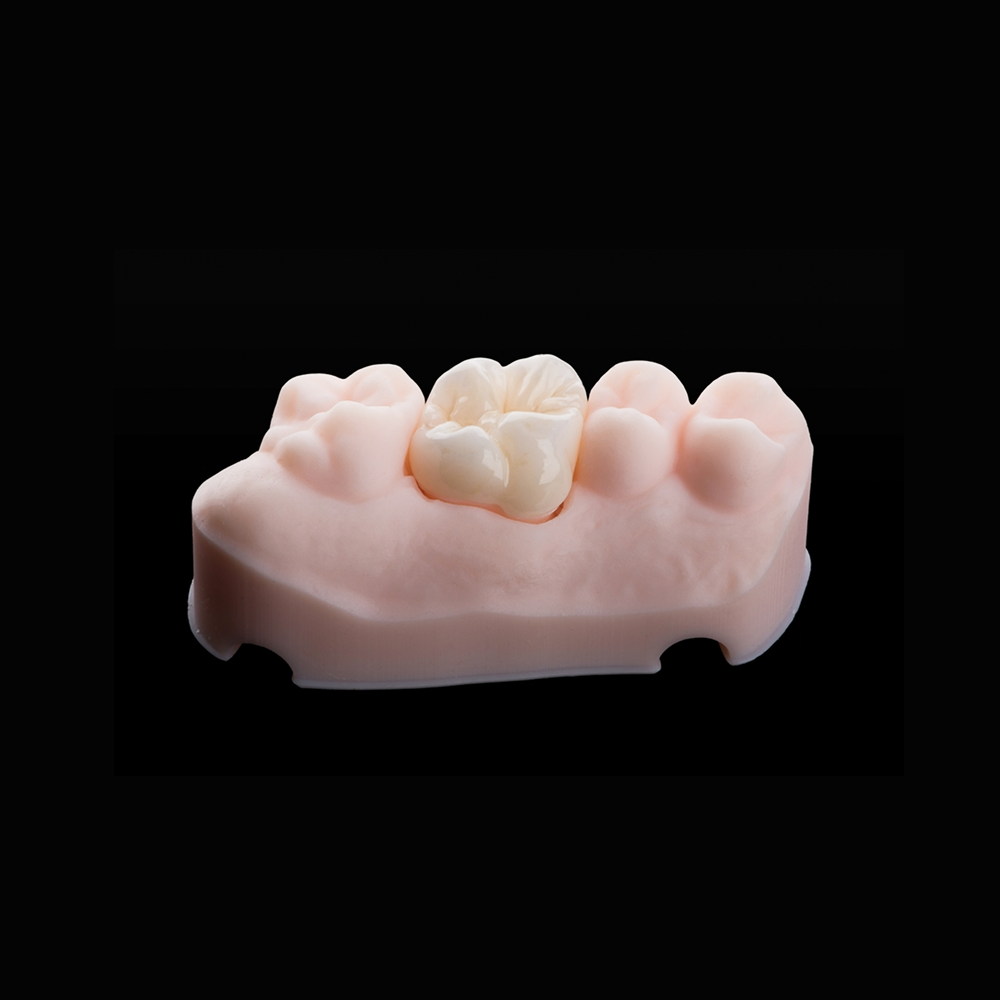 Crown and bridge dental restorations collection